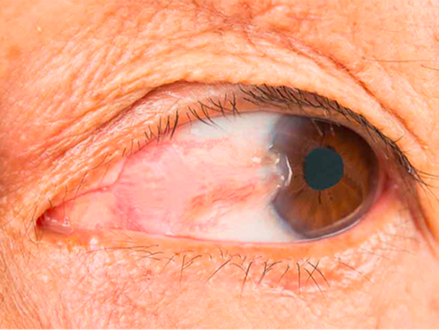 Farmacia oftalmológica