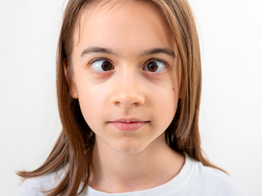 Cirugía de estrabismo