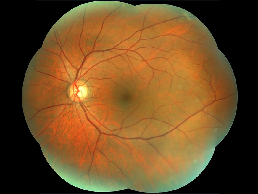 Cirugías oftalmológicas