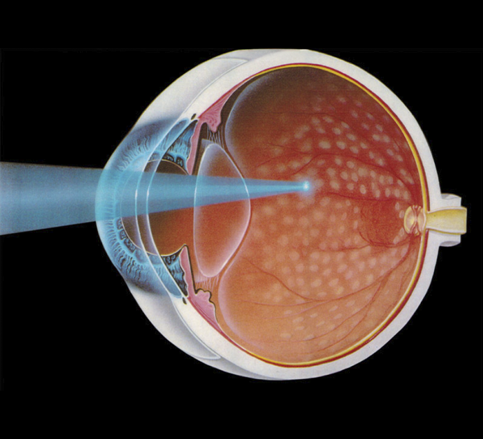 Cirugía oftalmológica en quirófano