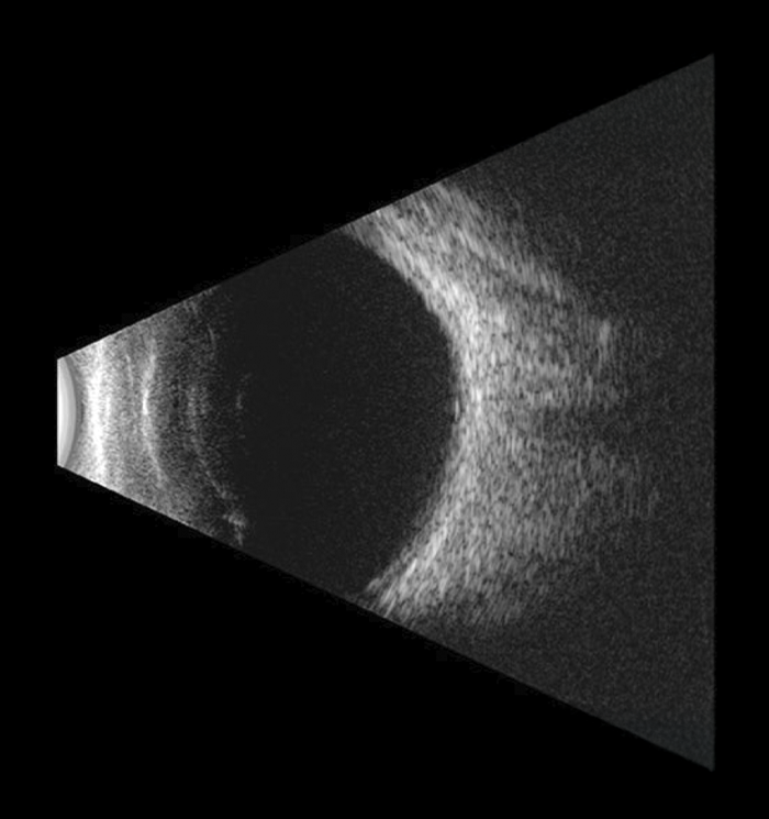 Cirugía oftalmológica en quirófano