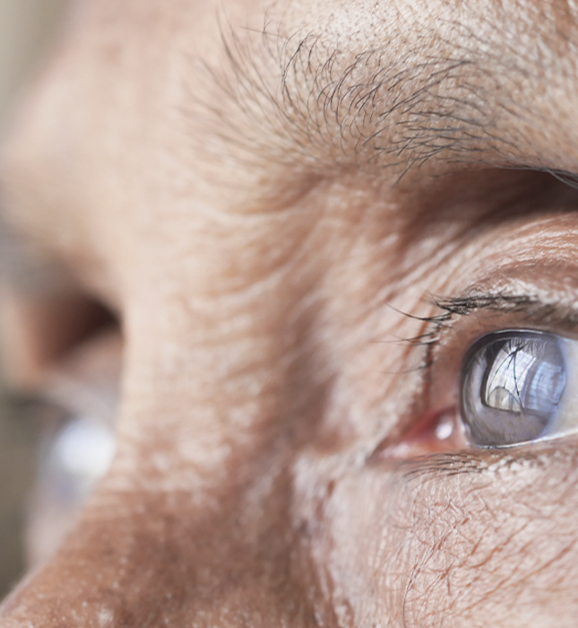 Cirugía oftalmológica en quirófano