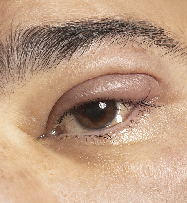 Cirugía oftalmológica en quirófano