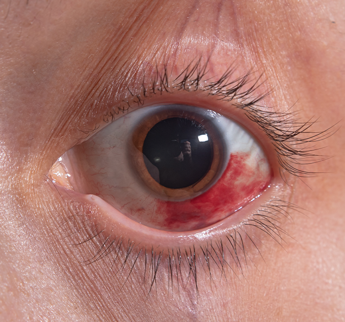 Consulta oftalmológica de alta especialidad