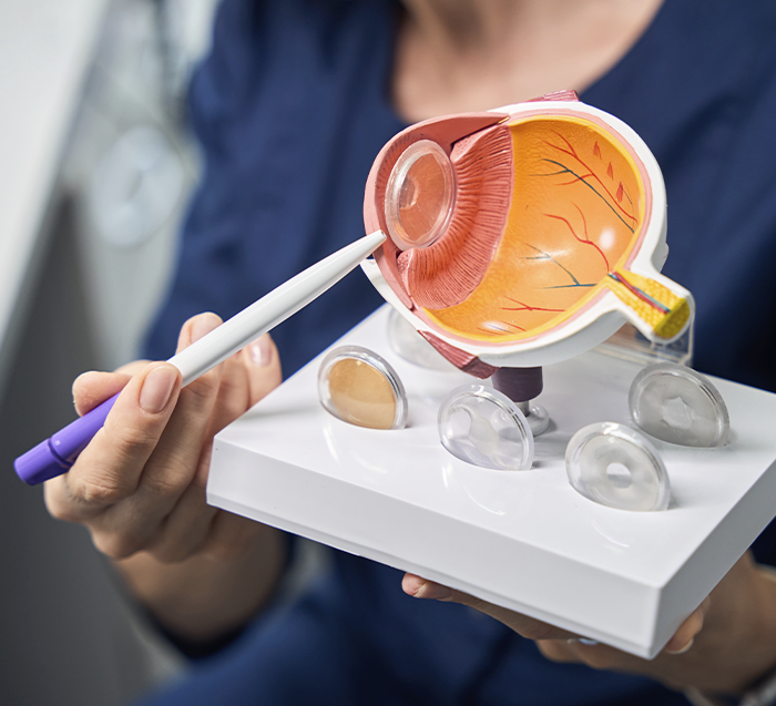 Consulta oftalmológica de alta especialidad