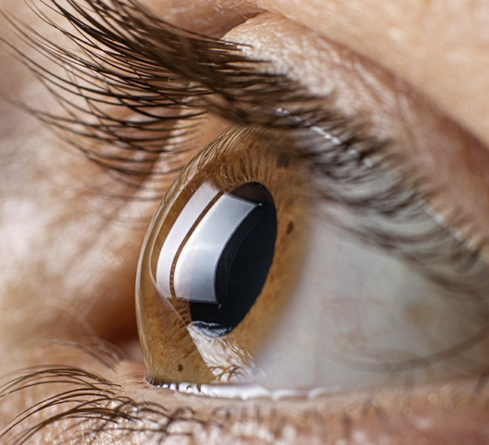 Consulta oftalmológica de alta especialidad