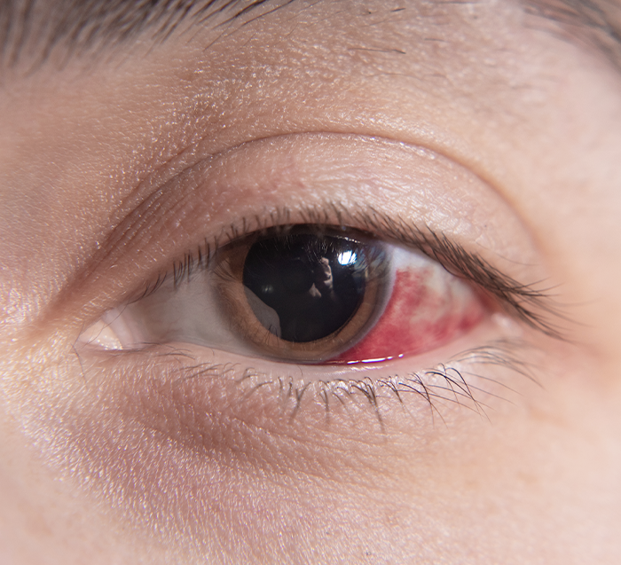 Consulta oftalmológica de alta especialidad