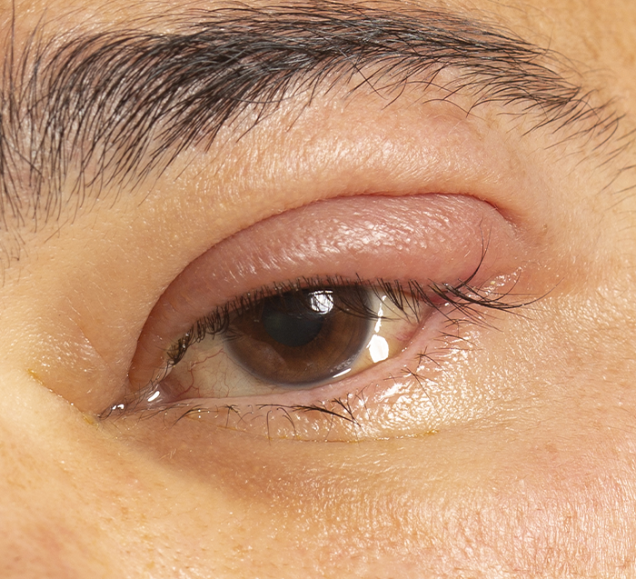 Consulta oftalmológica de alta especialidad