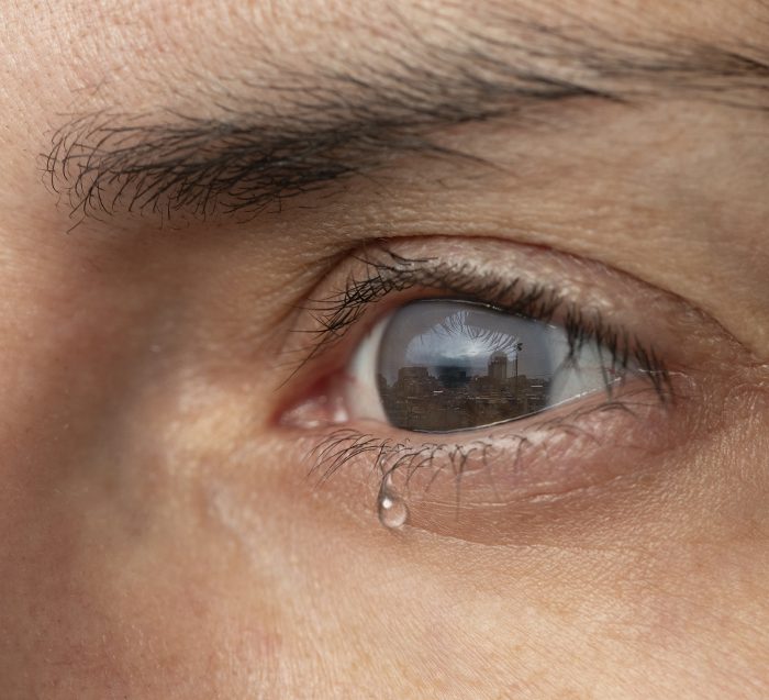 Consulta oftalmológica de alta especialidad