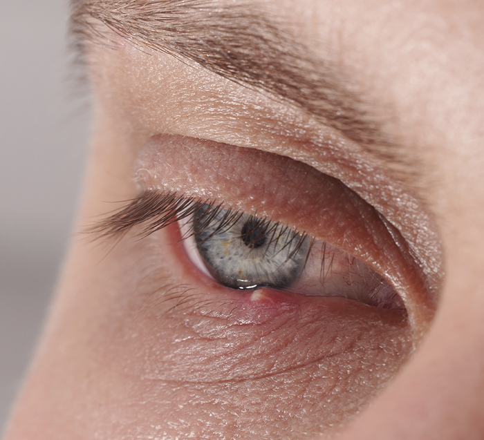 Consulta oftalmológica de alta especialidad