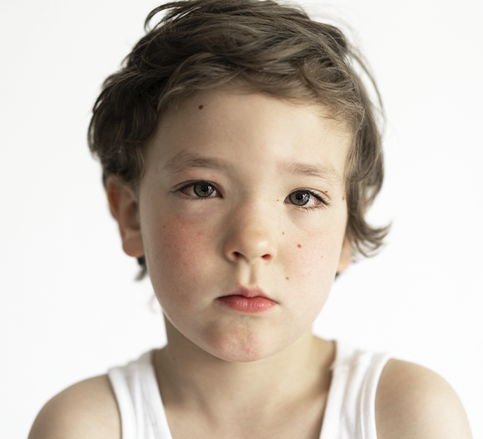 Consulta oftalmológica de alta especialidad